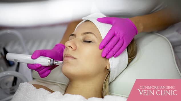9 Benefits Of Microneedling... Some You May Not Even Be Aware Of